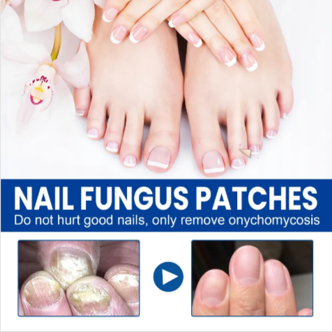 FungiPatch™ | Fungal Nail Patch | Eliminates up to 98% of nail fungus in just 8 days