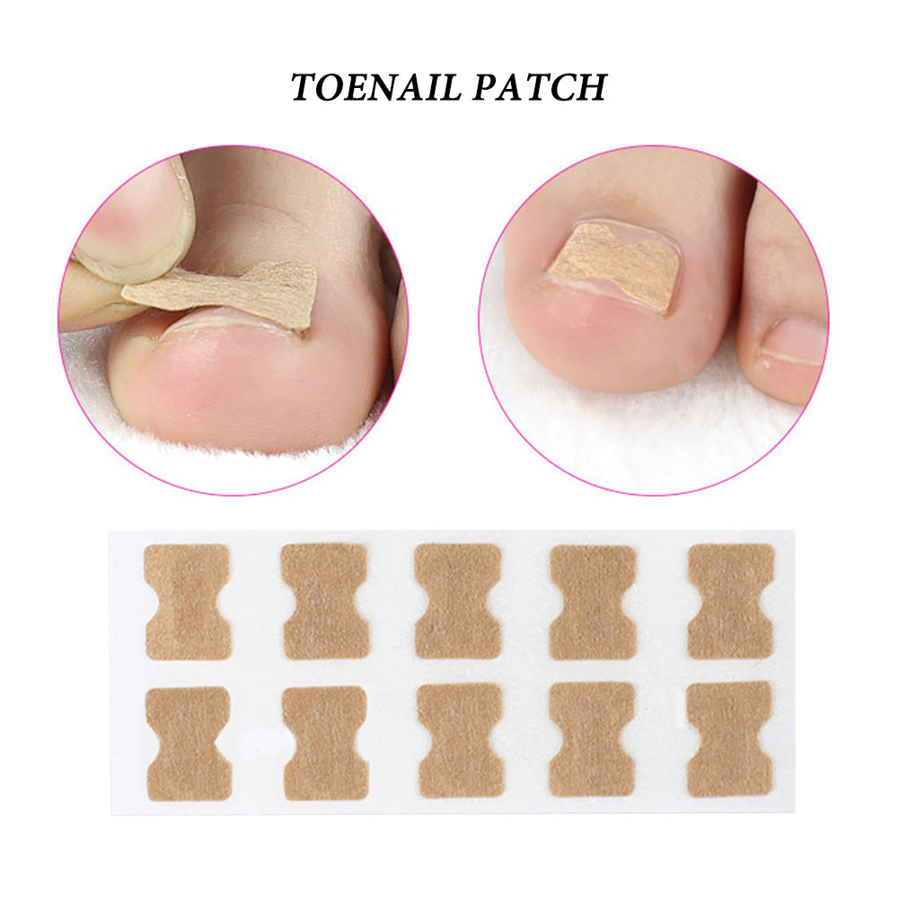 NailFix™ | Ingrown Nail Toenail Corrector